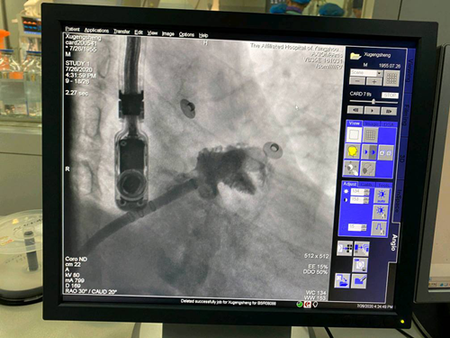 1596161311160938.png 图片2.png